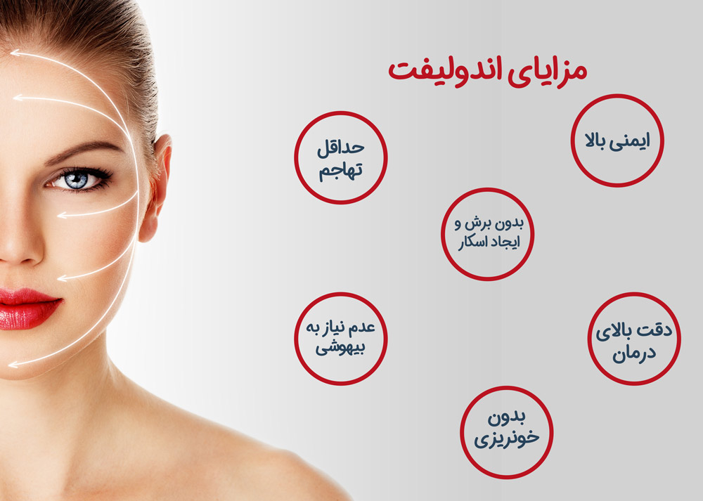 مزایا لیزر اندولیفت در مشهد