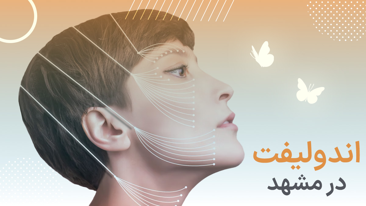 اندولیفت در مشهد