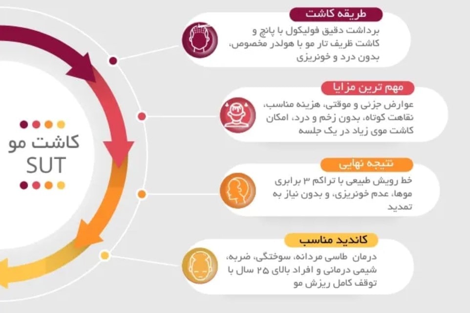 مزایا و معایب کاشت مو به روش SUT
