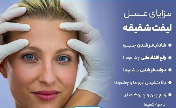 مزایا لیفت شقیقه در مشهد