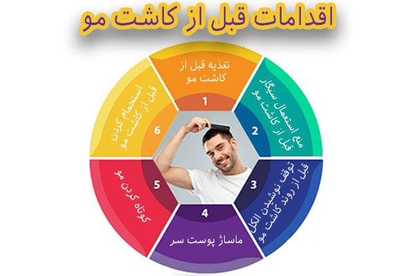 اقدامات قبل از کاشت مو در مشهد