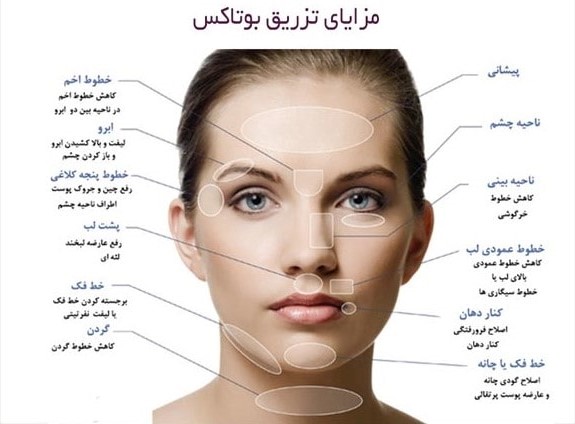 مزایا تزریق بوتاکس در مشهد