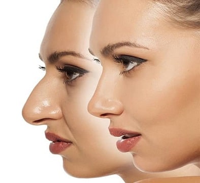 مزایا جراحی زیبایی اقساطی در مشهد