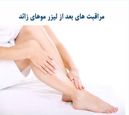 مراقبتهای قبل و بعد از لیزر موهای زائد مشهد
