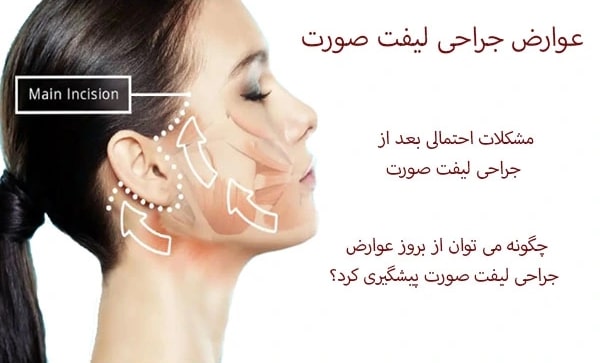 عوارض عمل لیفت صورت در مشهد