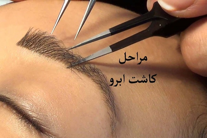 مراحل انجام کاشت ابرو در مشهد 