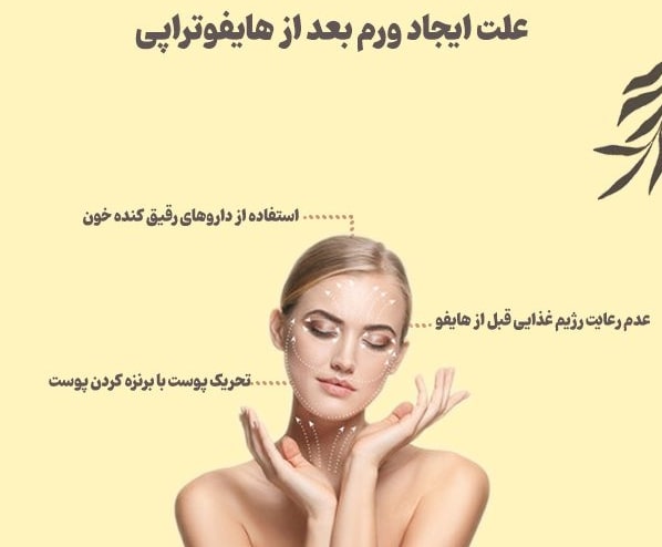 درمان ورم صورت بعد از هایفو مشهد