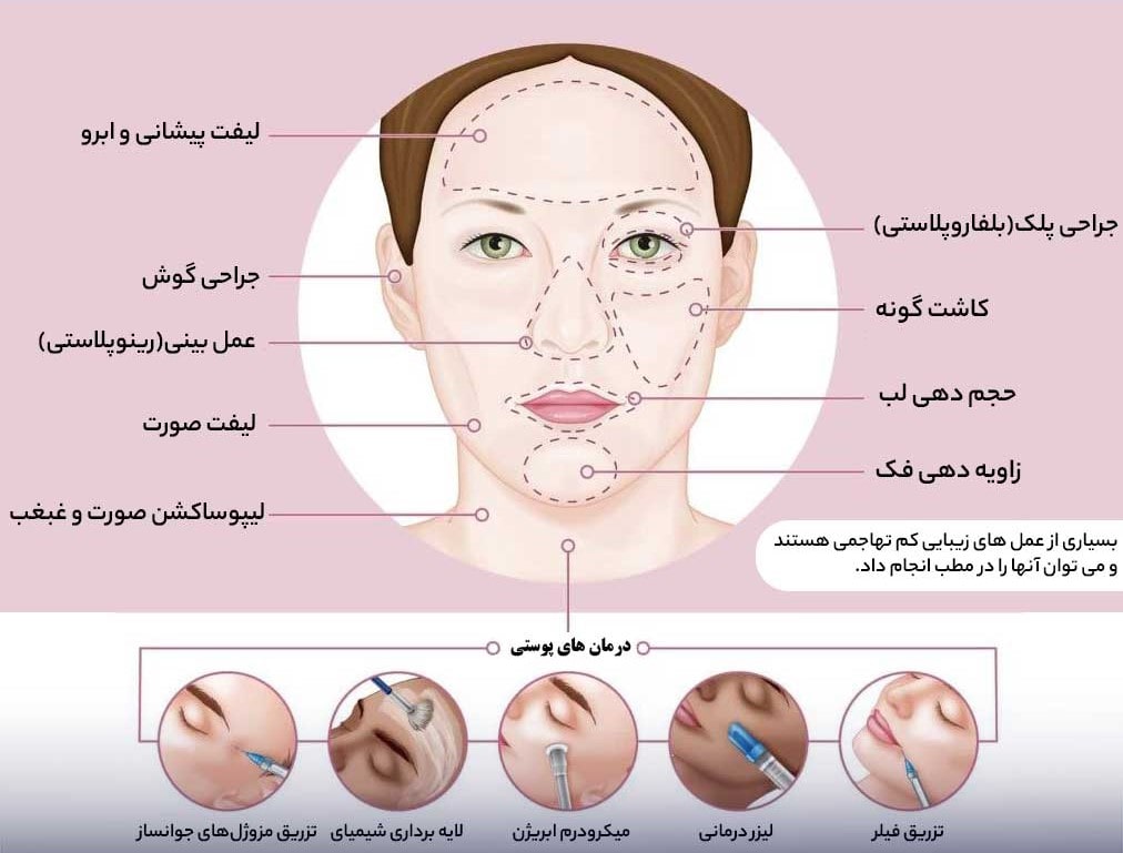 انواع جراحی پلاستیک