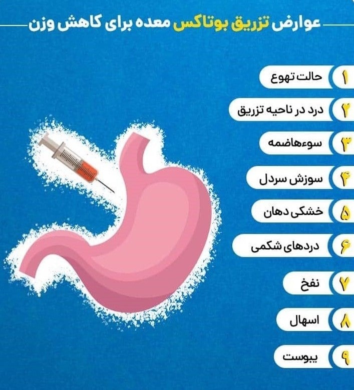 عوارض بوتاکس معده مشهد