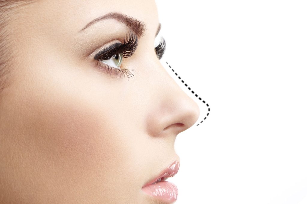روش های جراحی بینی استخوانی