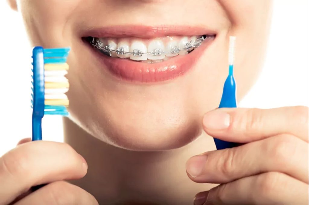 مراقبتهای پس از مراجعه به متخصص ارتودنسی مشهد