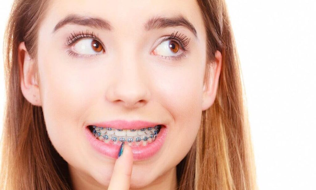 اقدامات لازم قبل از مراجعه به متخصص ارتودنسی مشهد