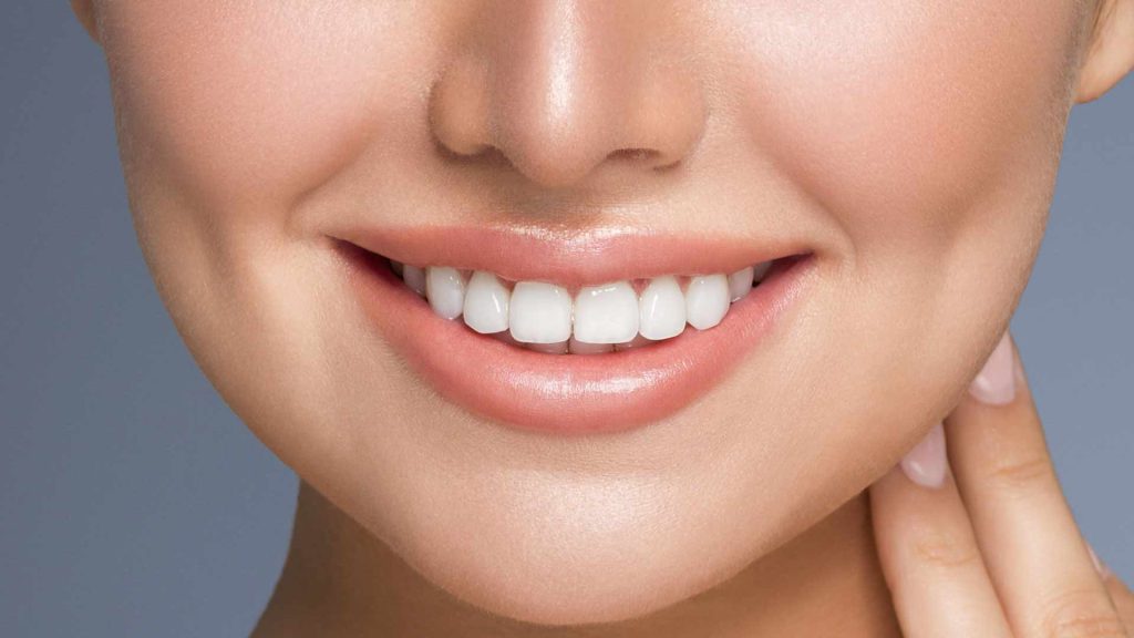 راههای کاهش قیمت لمینت دندان در مشهد