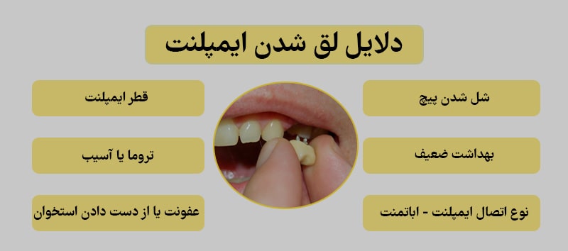 شل شدن ایمپلنت (راهکارهای پیشگیری، علائم و درمان)