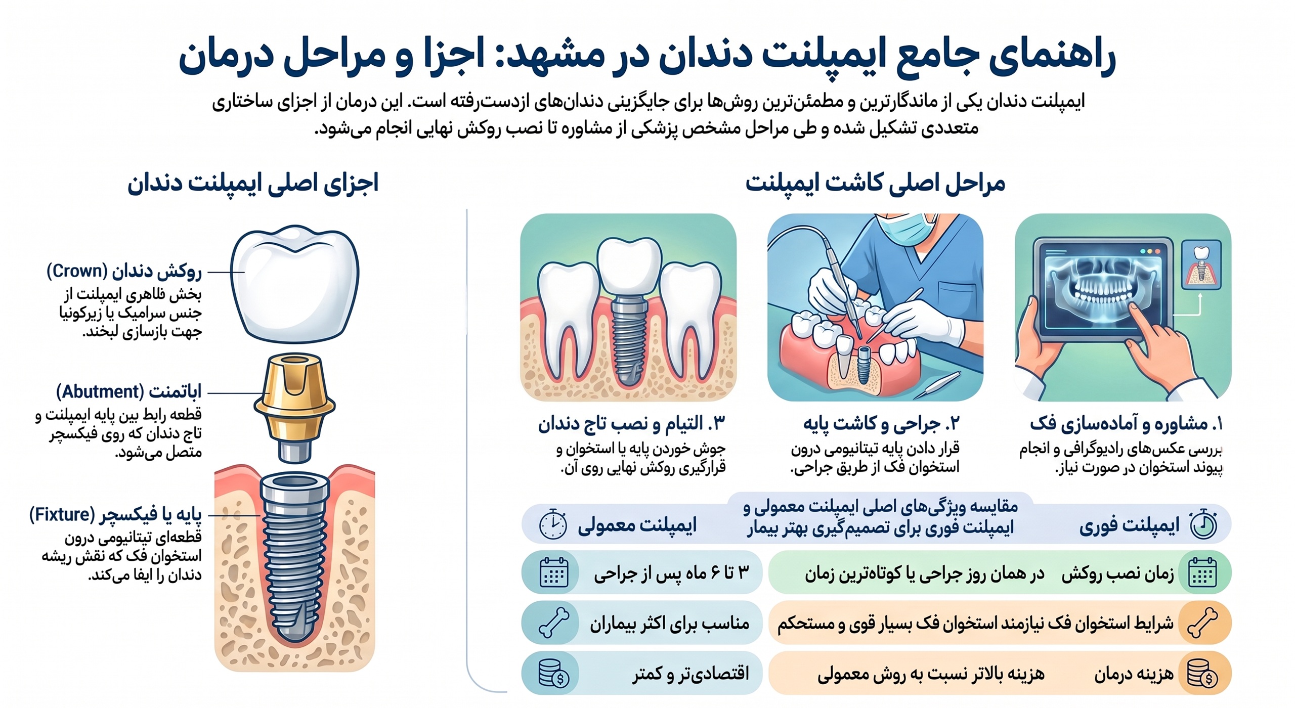 بهترین متخصص ایمپلنت در مشهد