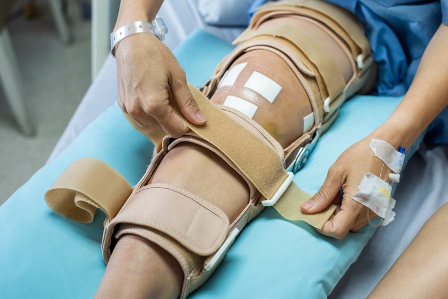 مراقبتهای بعد از جراحی افزایش قد در مشهد
