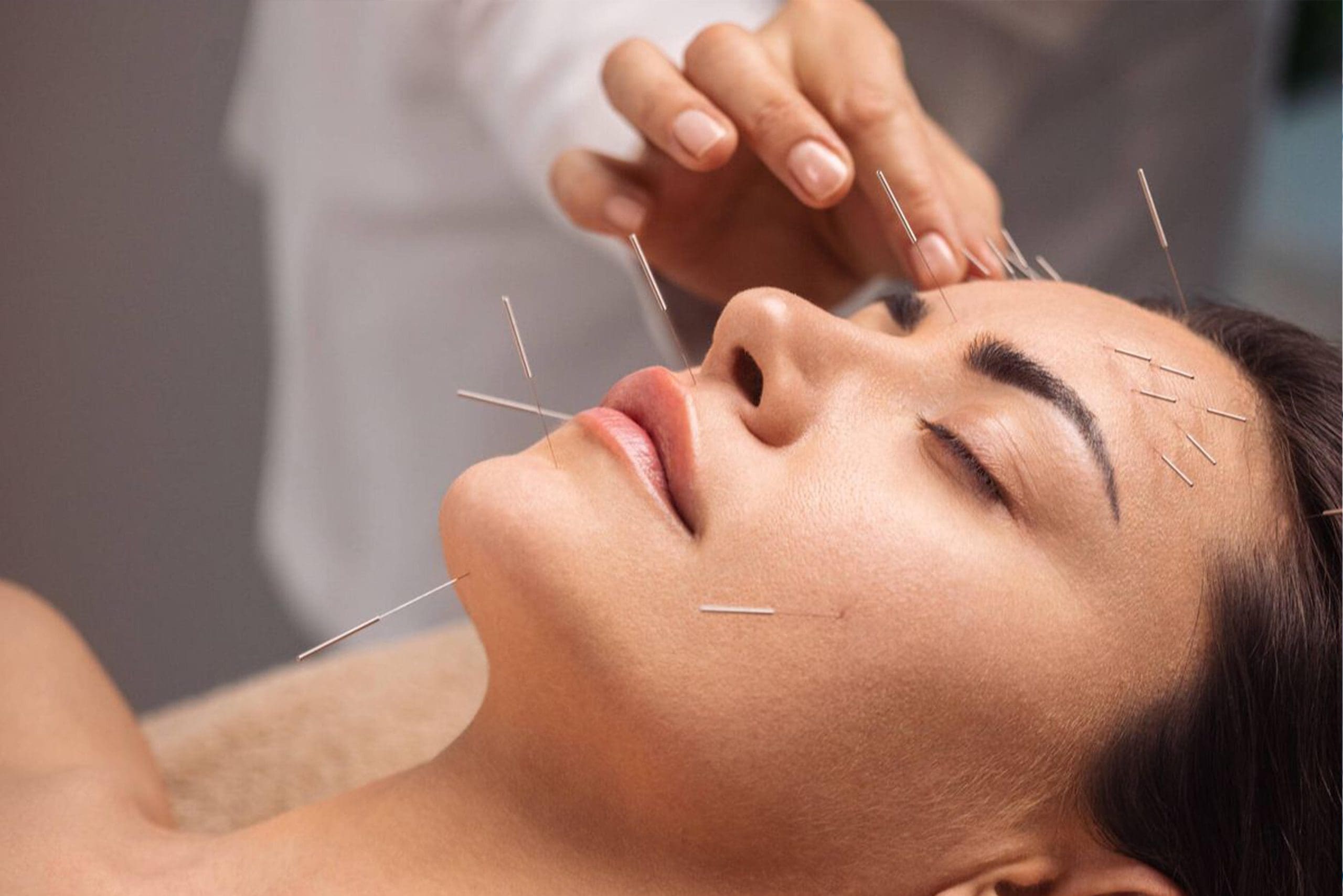ویژگیهای بهترین متخصص طب سوزنی در مشهد