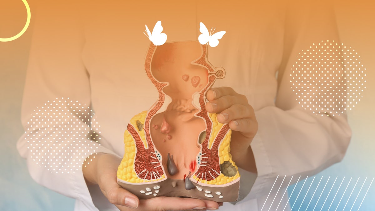بهترین دکتر متخصص بواسیر در مشهد