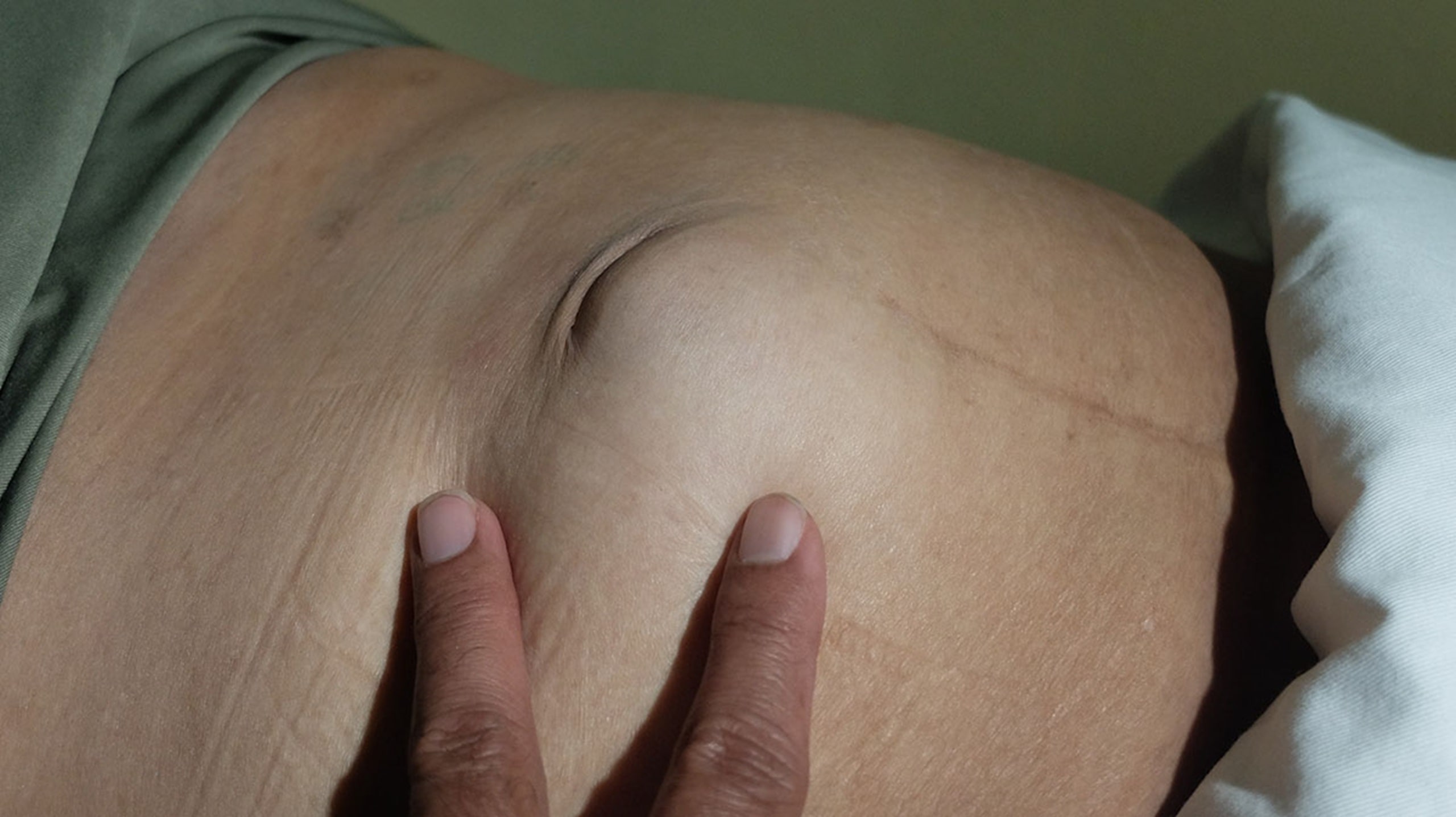علل مراجعه افراد به جراح عمومی مشهد