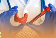 آزمایشگاه تیروئید مشهد