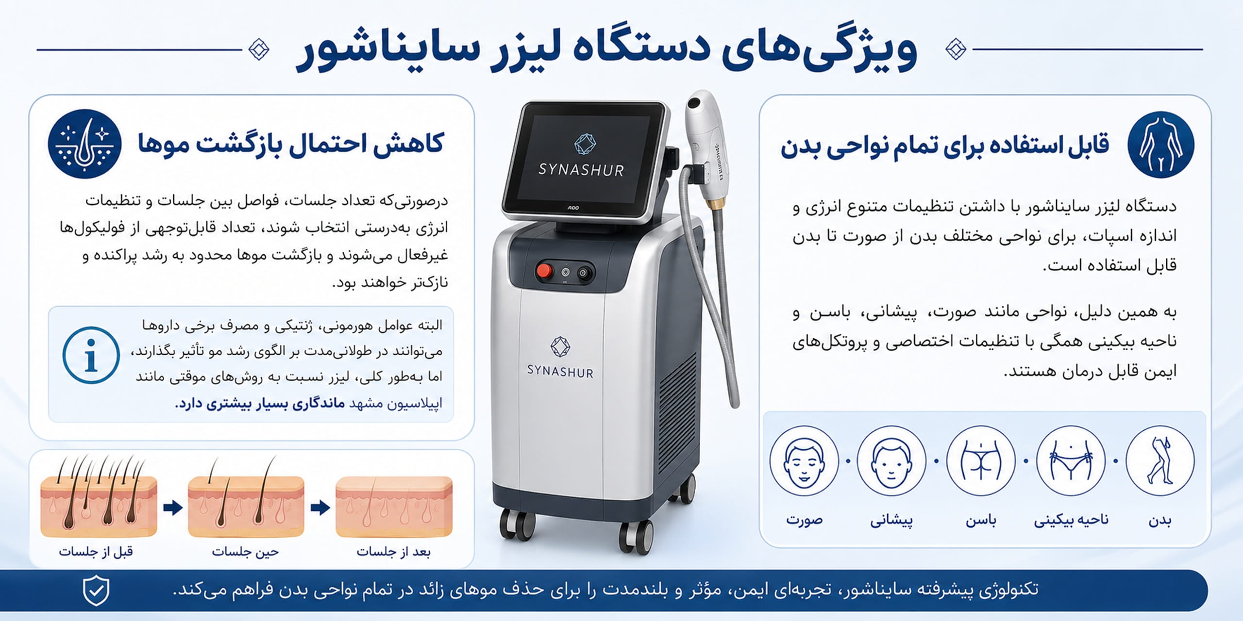 ویژگی‌ دستگاه لیزر سایناشور در مشهد